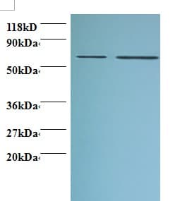 PHGDH Antibody
