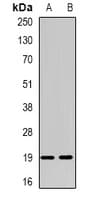 NUDT15 Antibody