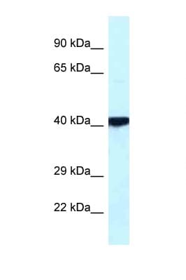 Polyclonal Rabbit anti-Human PRKACB Antibody (C-Terminus, WB)