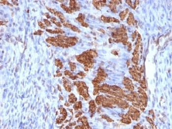 CNN1 / Calponin Antibody (clone CNN1/832 + CALP)