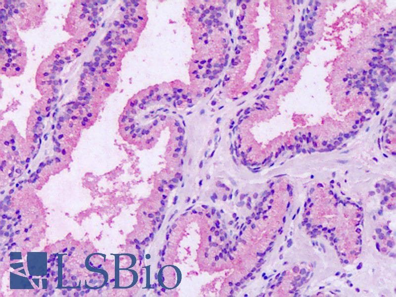 IHC-plus™ GPRC5A / RAI3 Antibody (Extracellular Domain)