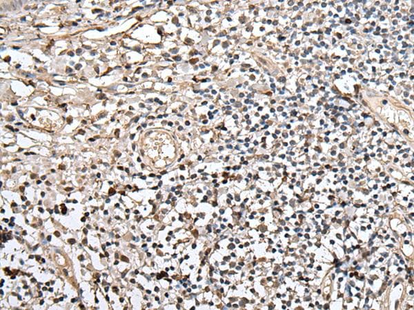 UTP3 / CRLZ1 Antibody