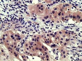 SH3GL1 / EEN Antibody (clone OTI2F5)
