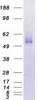 Human TEM7 Protein (Recombinant Myc-DDK (Flag))