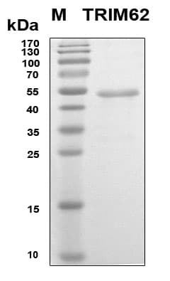 Human TRIM62 Protein (Recombinant 6His, N-terminus)