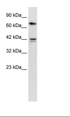 CACNB1 Antibody (aa21-70)