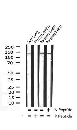 SMC1A / SMC1 Antibody (phospho-Ser957)
