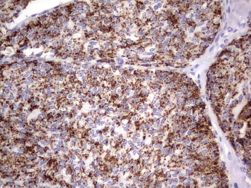 GBA / Glucosidase Beta Acid Antibody (aa40-315, clone OTI2C12)