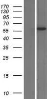 SLC13A5 Protein (Over-Expression Lysate Myc-DDK (Flag))