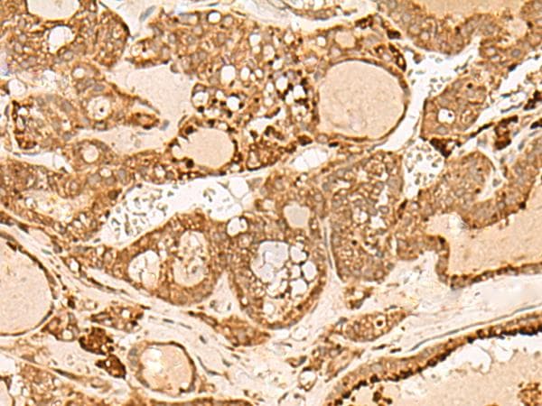 HIRIP3 Antibody