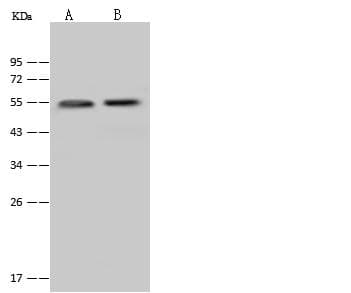 KRT13 / CK13 / Cytokeratin 13 Antibody (Preservative Free)