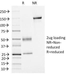 FOXA1 Antibody (clone FOXA1/1515)