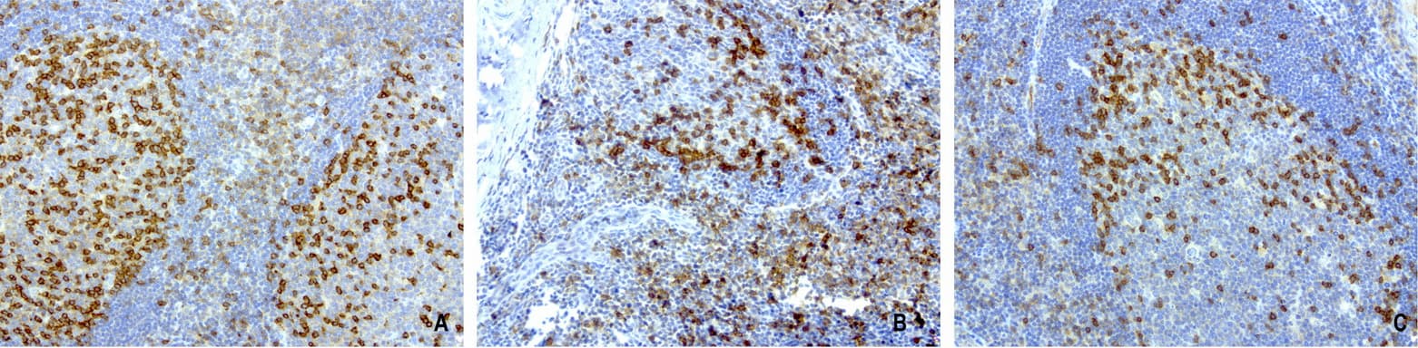 Monoclonal Mouse anti-Human PDCD1 / CD279 / PD-1 Antibody (clone UMAB198, Carrier-free, IHC, IF, WB)