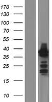Human HOMER2 / Homer 2 Protein (Over-Expression Lysate Myc-DDK (Flag))