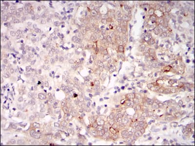 BLNK Antibody (clone 5G9)
