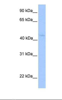 LIPT1 Antibody (N-Terminus)