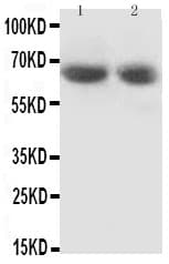 GAD65 Antibody (aa21-37)