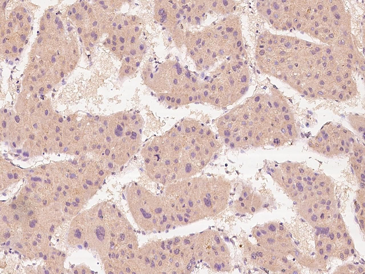 SPTLC2 / LCB2 Antibody