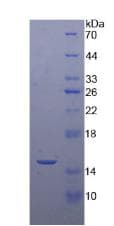 Human DROSHA / RNASEN Protein (Recombinant His, N-Terminal)