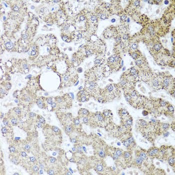 Polyclonal Rabbit anti-Human TSG101 Antibody (IHC, WB)