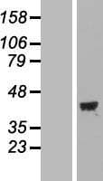 MOAP1 / MAP1 Protein (Over-Expression Lysate Myc-DDK (Flag))