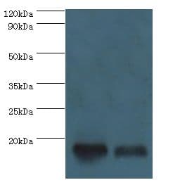 CLP / COTL1 Antibody (aa1-142)