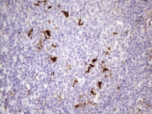 NR2C2 / TAK1 Antibody (aa1-241, clone OTI1B1)
