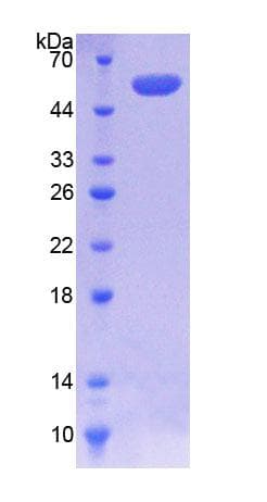 Human COQ6 Protein (Recombinant His-T7)