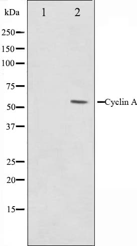 CCNA1 / Cyclin A1 Antibody