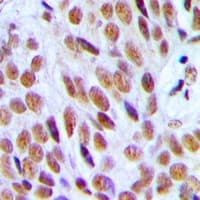 EP300 / p300 Antibody (N-Terminus)