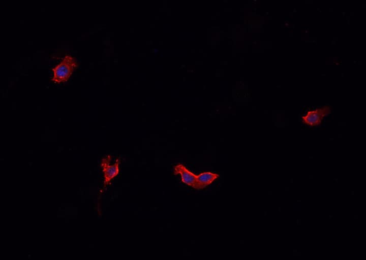 CALD1 / Caldesmon Antibody
