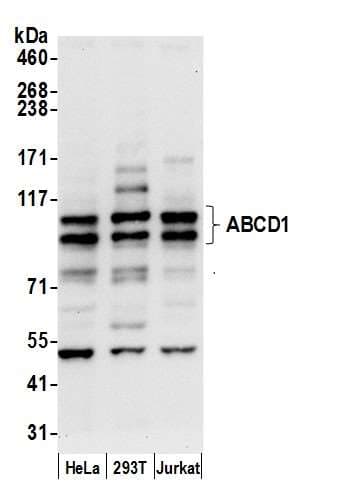 ALDP / ABCD1 Antibody (aa695-745)