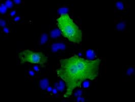 Monoclonal Mouse anti-Human SLIM / FHL1 Antibody (clone OTI2E1, IF, WB)