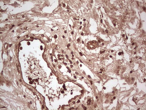 UBE2D2 / UBCH5B Antibody (clone OTI1D11)