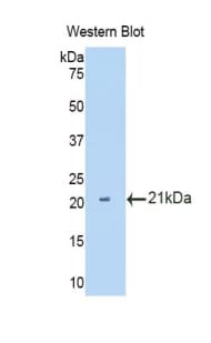 IL12RB2 Antibody (aa455-606)