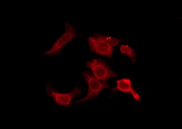 Polyclonal Rabbit anti-Human OR2D3 Antibody (IF, WB)