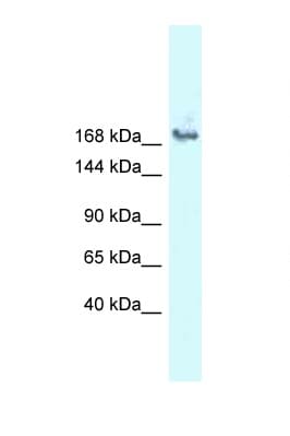 SNRNP200 Antibody (aa212-261)