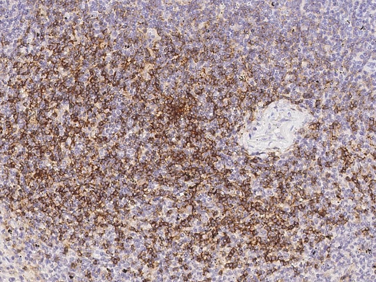CD4 Antibody (clone 23, Preservative Free)