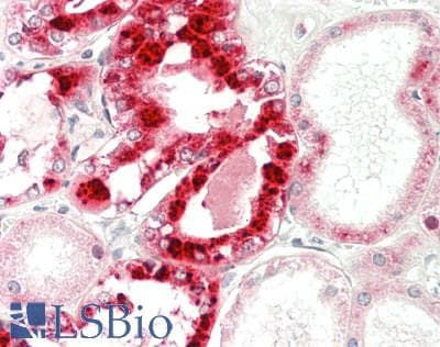 IHC-plus™ REN / Renin 1 Antibody (aa131-406, clone 2B9)