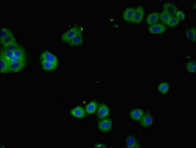 IL2RA / CD25 Antibody