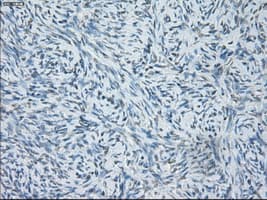 SORD / Sorbitol Dehydrogenase Antibody (clone OTI2A10)