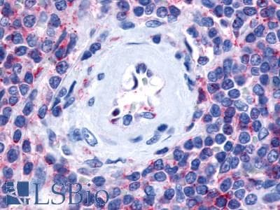 PathPlus™ P2Y13 / P2RY13 Antibody (Cytoplasmic Domain)