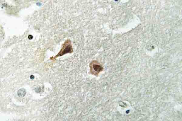 VCP Antibody (Ala346)