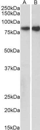 IHC-plus™ Polyclonal Goat anti-Human CDH1 / E Cadherin Antibody (aa662-675, IHC, WB)