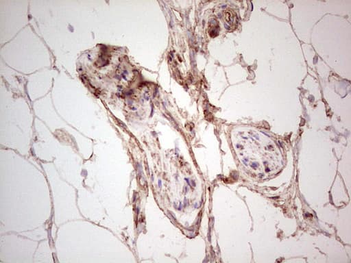 UBE2D2 / UBCH5B Antibody (clone OTI1D11)