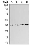 KHDRBS2 / SLM-1 Antibody