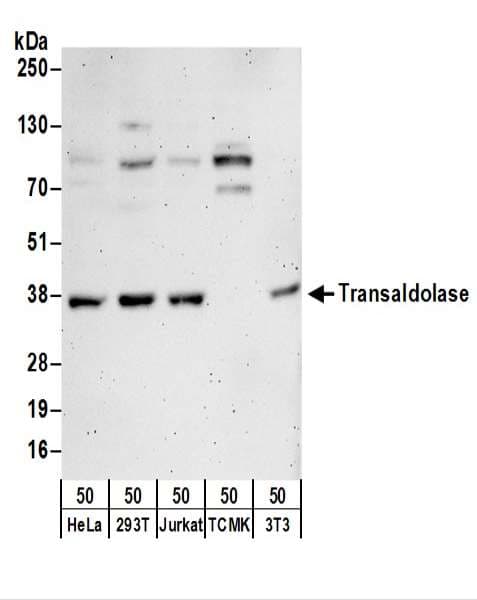 IHC-plus™ Polyclonal Rabbit anti-Human TALDO1 / Transaldolase 1 Antibody (aa200-250, IHC, WB)