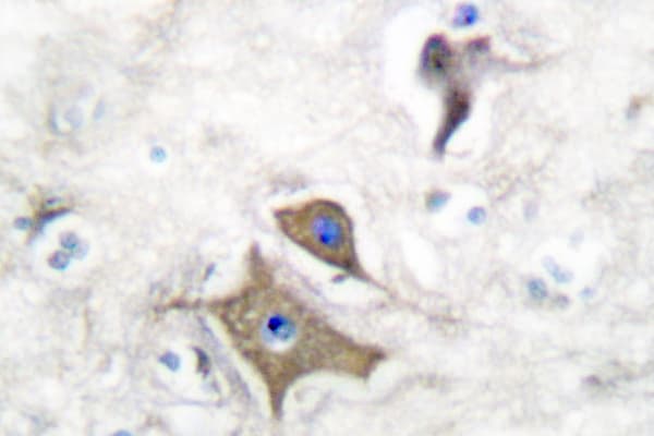 ENO2 / NSE Antibody (Arg400)