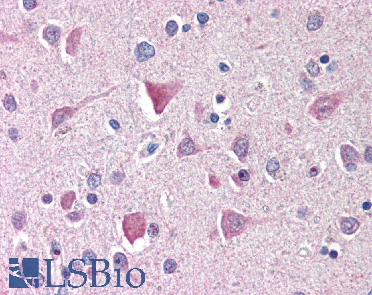 IHC-plus™ Polyclonal Rabbit anti-Human IL27RA Antibody (IHC, IF, WB)