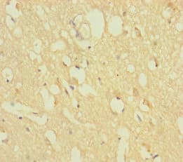 Polyclonal Rabbit anti-Human ZNF396 Antibody